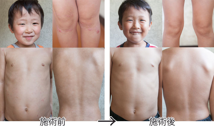 ビフォアアフター